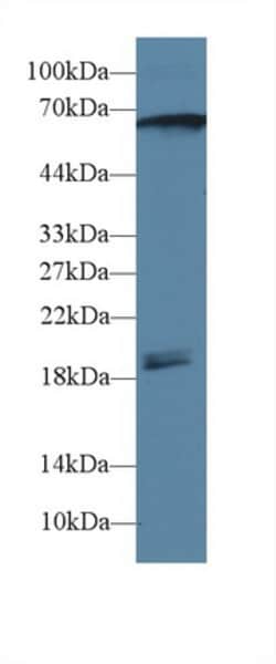 Invitrogen CaMKII gamma Polyclonal Antibody 20 &mu;L; Unconjugated:Antibodies,