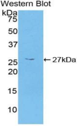 Invitrogen CaMKII gamma Polyclonal Antibody 20 &mu;L; Unconjugated:Antibodies,