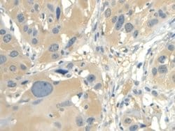 Invitrogen CALML3 Polyclonal Antibody:Antibodies:Primary Antibodies