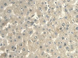Invitrogen CALML3 Polyclonal Antibody:Antibodies:Primary Antibodies