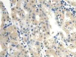 Invitrogen CALML3 Polyclonal Antibody:Antibodies:Primary Antibodies