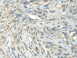Invitrogen CALML3 Polyclonal Antibody:Antibodies:Primary Antibodies