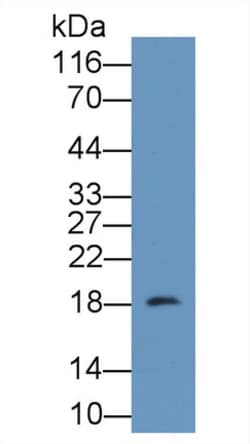Invitrogen CALML3 Polyclonal Antibody 20 &mu;L; Unconjugated:Antibodies,