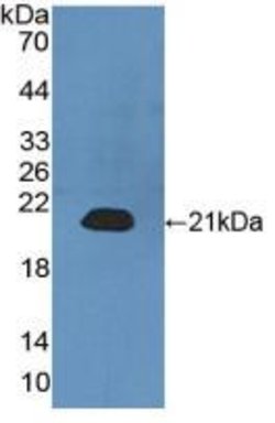 Invitrogen CALML3 Polyclonal Antibody:Antibodies:Primary Antibodies