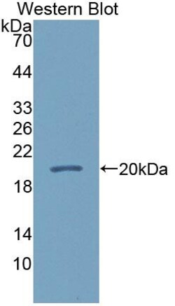 Invitrogen CALML5 Polyclonal Antibody 200 &mu;L; Unconjugated:Antibodies,