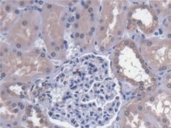 Invitrogen Calpain 9 Polyclonal Antibody 200 &mu;L; Unconjugated:Antibodies,