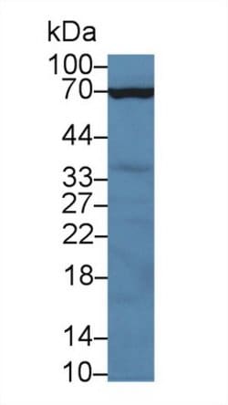 Invitrogen CD66e (CEA) Polyclonal Antibody 20 &mu;L; Unconjugated:Antibodies,