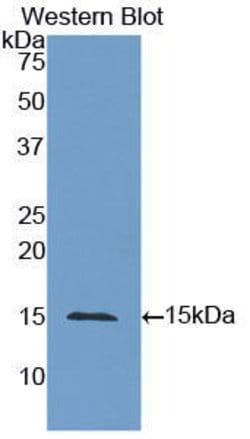 Invitrogen CD66e (CEA) Polyclonal Antibody 20 &mu;L; Unconjugated:Antibodies,