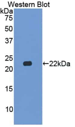 Invitrogen Beta-casein Polyclonal Antibody:Antibodies:Primary Antibodies