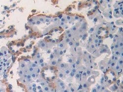 Invitrogen CK1 alpha Polyclonal Antibody 20 &mu;L | Buy Online | Invitrogen&trade; | Fisher Scientific