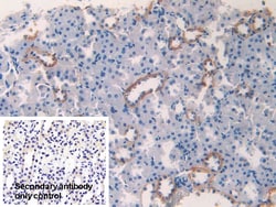 Invitrogen CK1 alpha Polyclonal Antibody 20 &mu;L | Buy Online | Invitrogen&trade; | Fisher Scientific