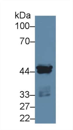 Invitrogen CK1 alpha Polyclonal Antibody 20 &mu;L | Buy Online | Invitrogen&trade; | Fisher Scientific