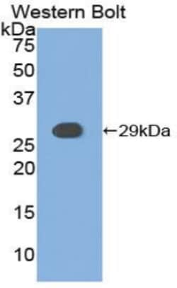Invitrogen CK1 alpha Polyclonal Antibody 20 &mu;L | Buy Online | Invitrogen&trade; | Fisher Scientific