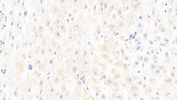 Invitrogen Caspase 1 Polyclonal Antibody:Antibodies:Primary Antibodies