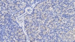 Invitrogen Caspase 1 Polyclonal Antibody:Antibodies:Primary Antibodies