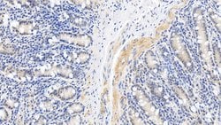 Invitrogen Caspase 1 Polyclonal Antibody:Antibodies:Primary Antibodies