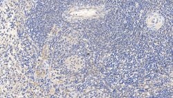 Invitrogen Caspase 1 Polyclonal Antibody:Antibodies:Primary Antibodies
