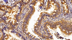 Invitrogen Caspase 1 Polyclonal Antibody:Antibodies:Primary Antibodies