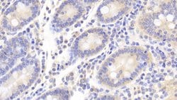 Invitrogen Caspase 1 Polyclonal Antibody 200 &mu;L; Unconjugated:Antibodies,
