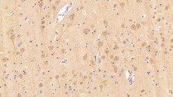Invitrogen Caspase 1 Polyclonal Antibody 200 &mu;L; Unconjugated:Antibodies,