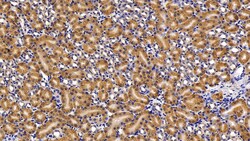 Invitrogen Caspase 1 Polyclonal Antibody 200 &mu;L; Unconjugated:Antibodies,
