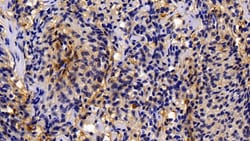 Invitrogen Caspase 1 Polyclonal Antibody 200 &mu;L; Unconjugated:Antibodies,