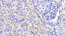 Invitrogen Caspase 2 Polyclonal Antibody:Antibodies:Primary Antibodies