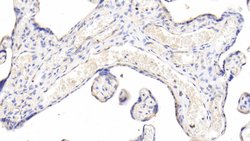 Invitrogen Caspase 2 Polyclonal Antibody:Antibodies:Primary Antibodies
