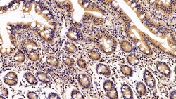 Invitrogen Caspase 2 Polyclonal Antibody 200 &mu;L; Unconjugated:Antibodies,