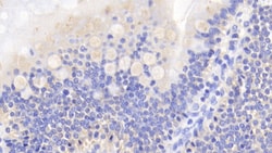Invitrogen Caspase 2 Polyclonal Antibody:Antibodies:Primary Antibodies