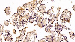 Invitrogen Caspase 2 Polyclonal Antibody 200 &mu;L; Unconjugated:Antibodies,