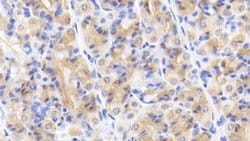 Invitrogen Caspase 2 Polyclonal Antibody:Antibodies:Primary Antibodies