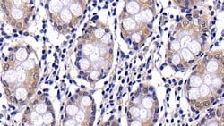 Invitrogen Caspase 2 Polyclonal Antibody:Antibodies:Primary Antibodies