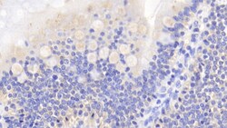 Invitrogen Caspase 2 Polyclonal Antibody 200 &mu;L; Unconjugated:Antibodies,