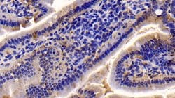 Invitrogen Caspase 7 Polyclonal Antibody:Antibodies:Primary Antibodies