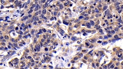 Invitrogen Caspase 8 Polyclonal Antibody 200 &mu;L; Unconjugated:Antibodies,