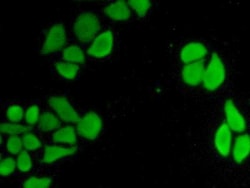 Invitrogen CARD9 Polyclonal Antibody 20 &mu;L; Unconjugated:Antibodies,