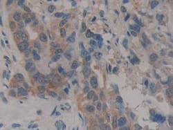 Invitrogen CARD9 Polyclonal Antibody 20 &mu;L; Unconjugated:Antibodies,