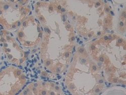 Invitrogen CARD9 Polyclonal Antibody 20 &mu;L; Unconjugated:Antibodies,