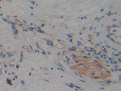 Invitrogen CARD9 Polyclonal Antibody 20 &mu;L; Unconjugated:Antibodies,