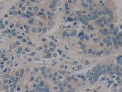 Invitrogen CARD9 Polyclonal Antibody 20 &mu;L; Unconjugated:Antibodies,