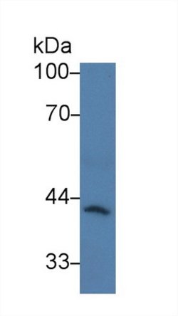 Invitrogen CARD9 Polyclonal Antibody 20 &mu;L; Unconjugated:Antibodies,