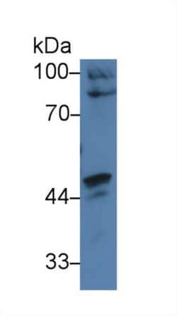 Invitrogen CARD9 Polyclonal Antibody 20 &mu;L; Unconjugated:Antibodies,
