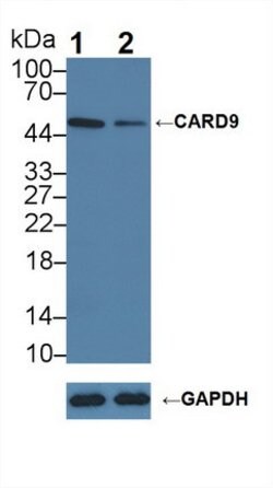 Invitrogen CARD9 Polyclonal Antibody 20 &mu;L; Unconjugated:Antibodies,