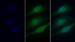 Invitrogen Catalase Polyclonal Antibody 200 &mu;L; Unconjugated:Antibodies,