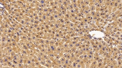 Invitrogen Catalase Polyclonal Antibody 200 &mu;L; Unconjugated:Antibodies,