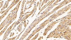 Invitrogen Catalase Polyclonal Antibody 200 &mu;L; Unconjugated:Antibodies,