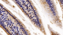 Invitrogen Catalase Polyclonal Antibody 200 &mu;L; Unconjugated:Antibodies,