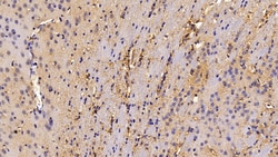 Invitrogen Catalase Polyclonal Antibody 200 &mu;L; Unconjugated:Antibodies,