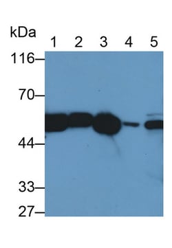 Invitrogen Catalase Polyclonal Antibody 200 &mu;L; Unconjugated:Antibodies,